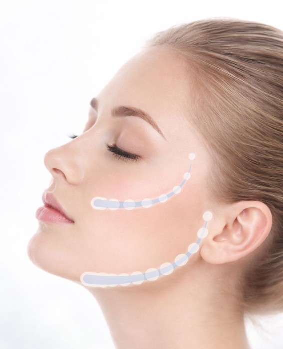 フェイスライン